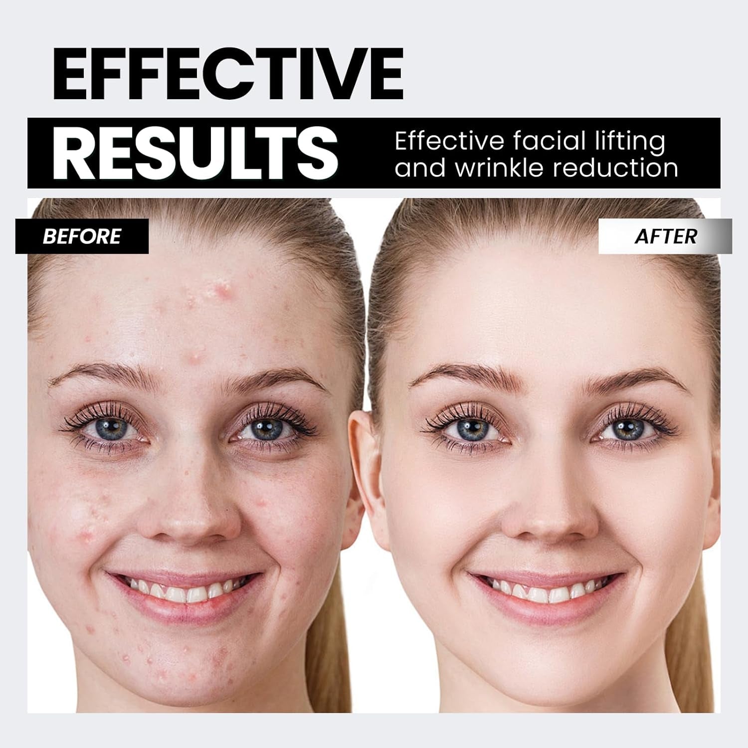 Microcurrent Facial Device,Latest Red Light Technology，Enhances the Ability to Lift the Face and Tighten the Skin，Facial Wrinkle Equipment，Smart Photon Micro-Current Device, Model:Ep-300.