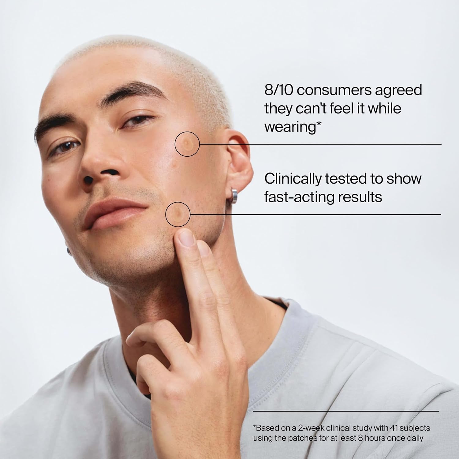 Neutrogena Stubborn Acne Patches, Hydrocolloid Absorbs Impurities Ultra-Thin Pimple Patches Work Overnight, 24 Ct