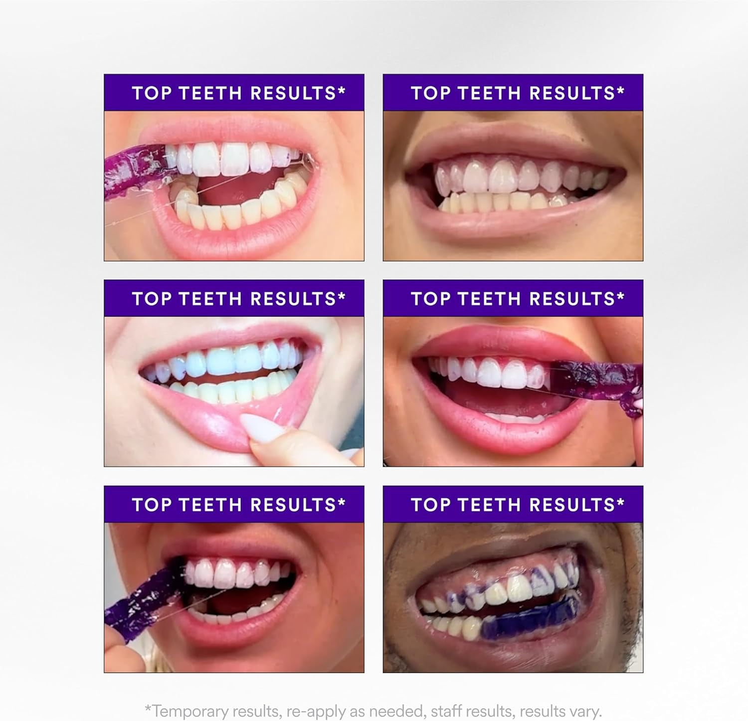V34 Whitening Strips, Teeth Whitening Strips, Purple Tooth Whitening, Purple Whitening Strips, Tooth Stain Treatment, Combining Whitening and Colour Correction