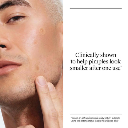 Neutrogena Stubborn Acne Patches, Hydrocolloid Absorbs Impurities Ultra-Thin Pimple Patches Work Overnight, 24 Ct