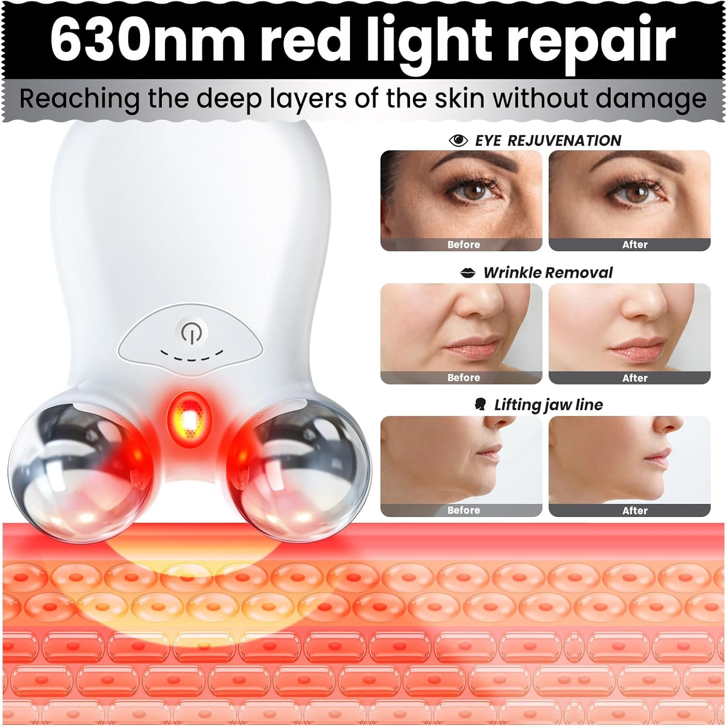 Microcurrent Facial Device,Latest Red Light Technology，Enhances the Ability to Lift the Face and Tighten the Skin，Facial Wrinkle Equipment，Smart Photon Micro-Current Device, Model:Ep-300.